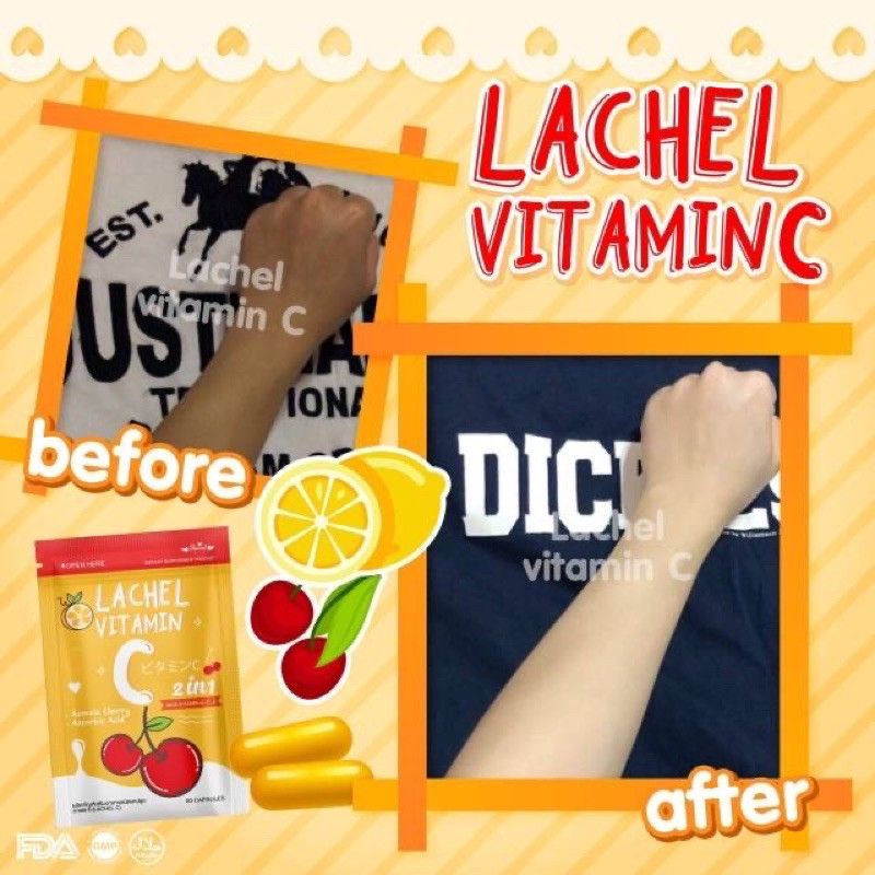 LACHEL VIT C / LACHEL VITAMIN C 100% ORIGINAL THAILAND