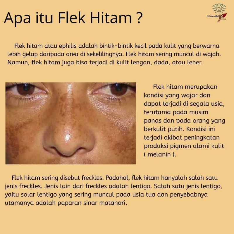 (COD)TERAMPUH ATASI FLEK HITAM//KRIM SPOT SR12 FLEK HITAM//SERUM GOLD SR12//FACIAL WASH COFFEE SR12