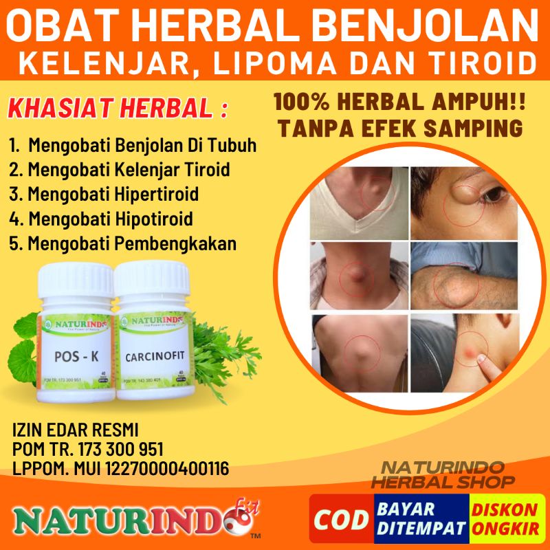 Jual Obat Benjolan Lipoma Kelenjar Herbal Paling Ampuh Benjolan Limpoma