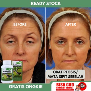 Jual Sipit Harga Terbaik November 2021 Shopee Indonesia