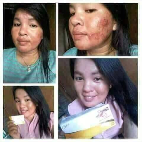 collaskin collagen skin care paket Original PT.Natural Nusantara