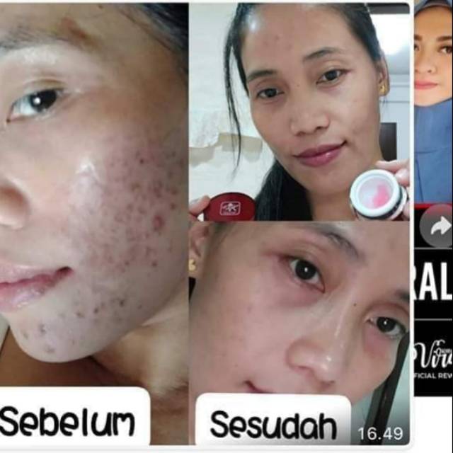 RK RED JELLY GLOWING