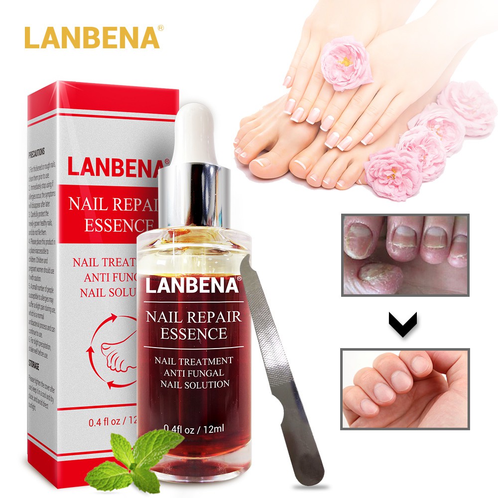 LANBENA Obat Jamur Kuku Perawatan Kesehatan Menghilangkan Jamur Kuku
