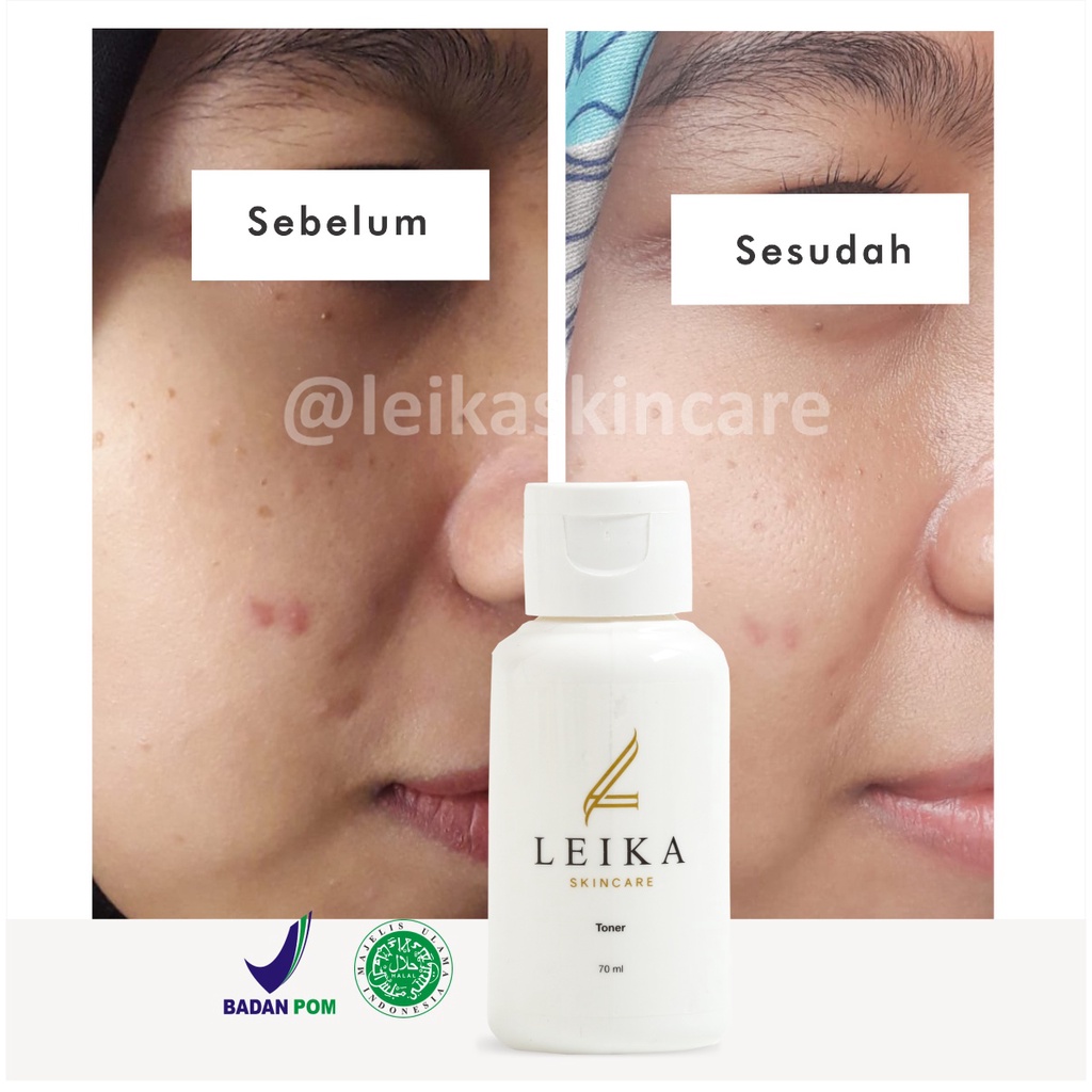 Toner Pelembab Kulit Wajah Kering / Berminyak Pelembab Wajah Cepat Bikin Putih Mencerahkan dan Glowing Ampuh Toner Leika Skincare Halal MUI Resmi BPOM