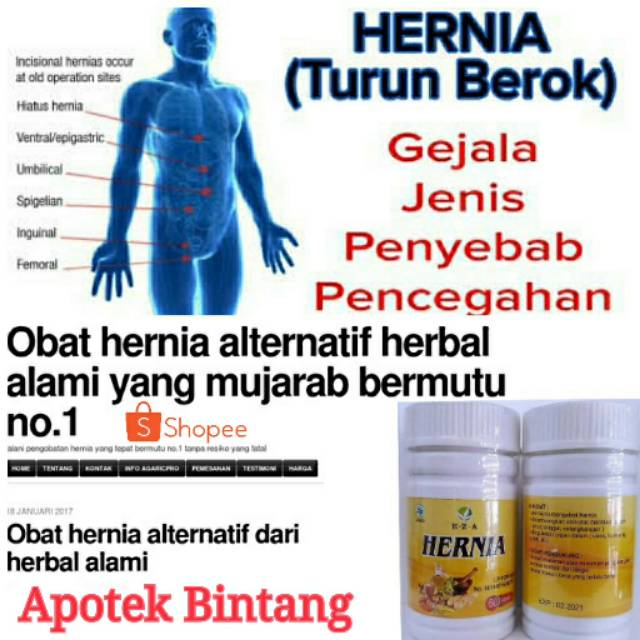 Obat Hernia Ampuh Kapsul Ramuan Herbal Tradisional Obati Penyakit Hernia Ato Turun Berok Bero Shopee Indonesia