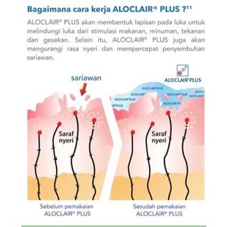 Aloclair Gel Obat Sariawan