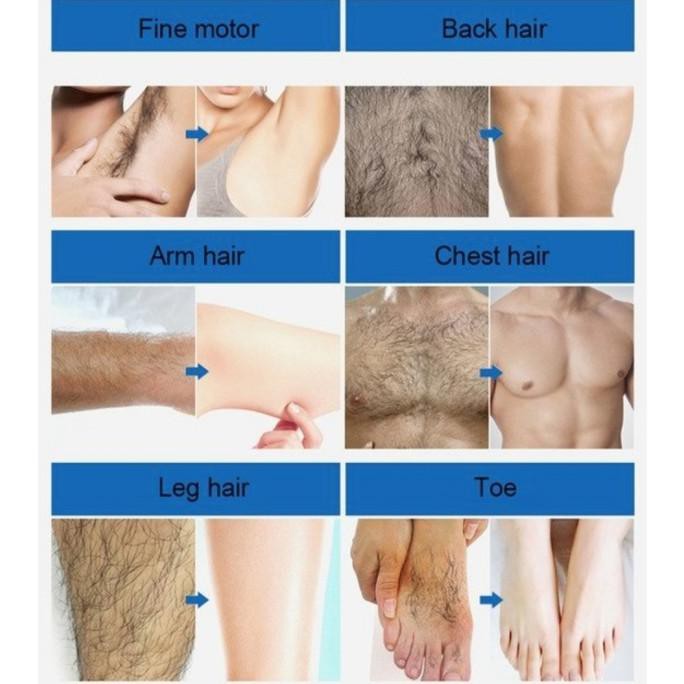 Koogis Cream Perontok Bulu Permanen Original/Natural Hair Removal