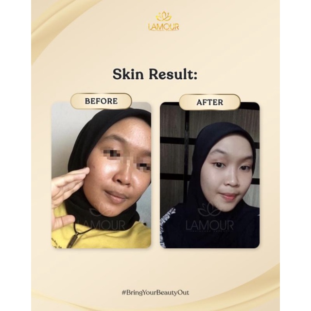 KRIM MALAM NIGHT CREAM LAMOUR PELEMBAB PEMUTIH PENCERAH WAJAH AMAN BUMIL BUSUI BPOM HALAL SKINCARE RUTIN HARIAN-8