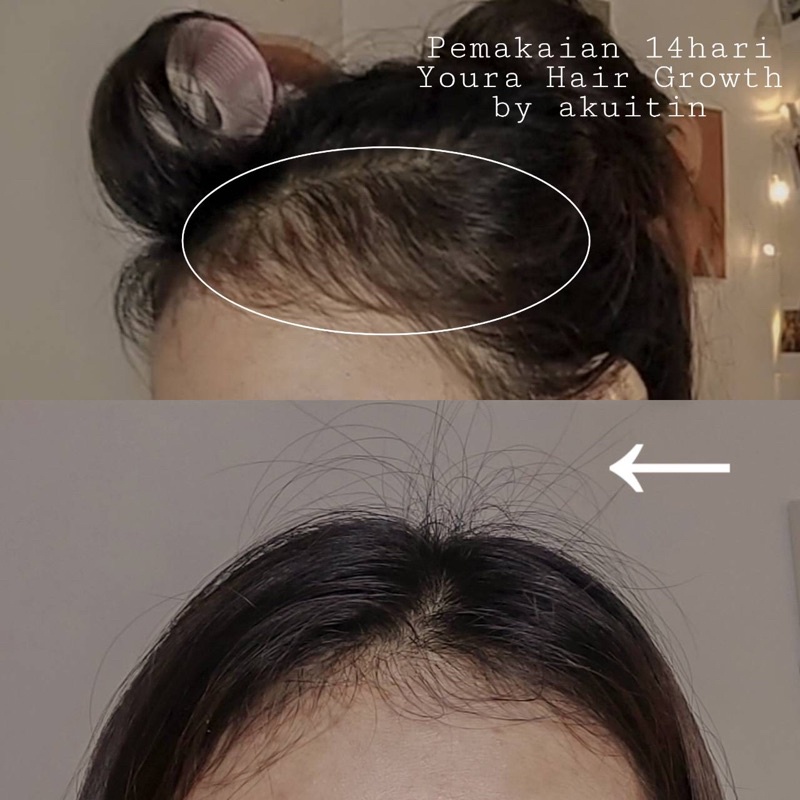 Youra Hair Tonic Growth Serum | Penyubur rambut & Mengatasi rambut rontok by akuitin-1