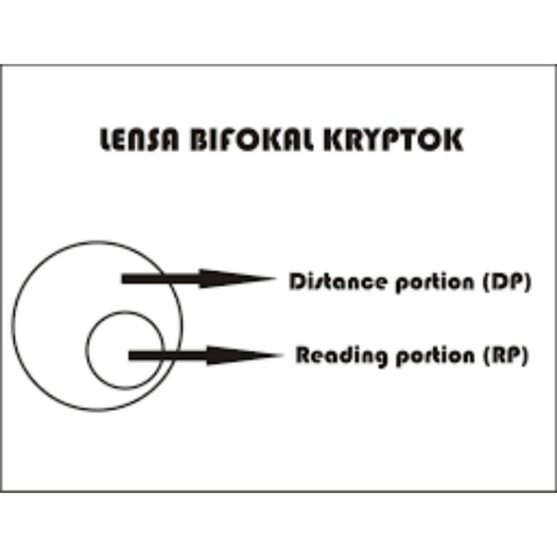 BIAYA PENAMBAHAN LENSA BIFOCAL (KRYPTOK)