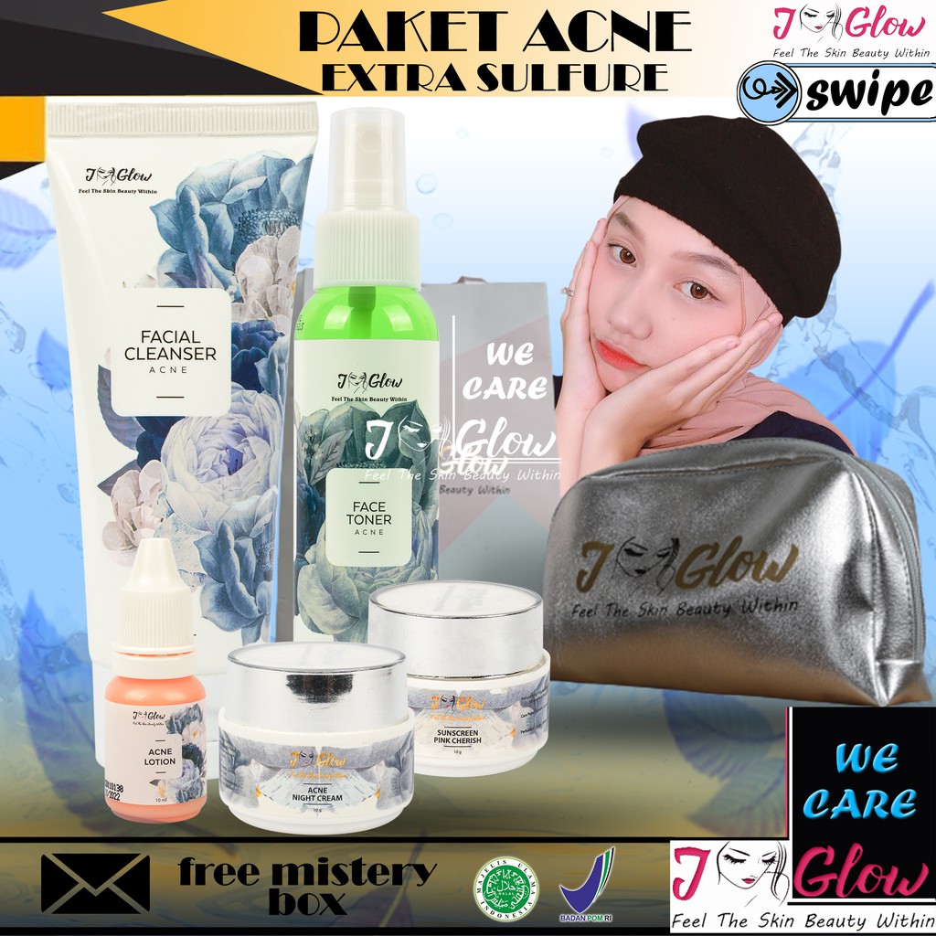 Jual JGLOW BPOM Skincare Paket J Glow Acne Ex Sulfur Skin Care Wajah