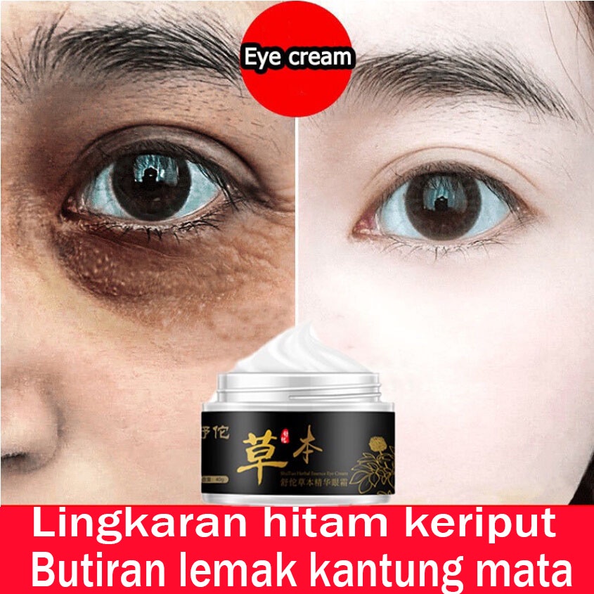 Krim mata lingkaran hitam Krim mata butiran lemak Cerahkan krim mata Minyak mata Esensi mata Perawatan mata Menghilangkan partikel lemak Kantung di bawah mata Pelembab