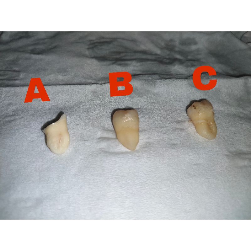 gigi bungsu asli manusia bahan praktikum kedokteran gigi