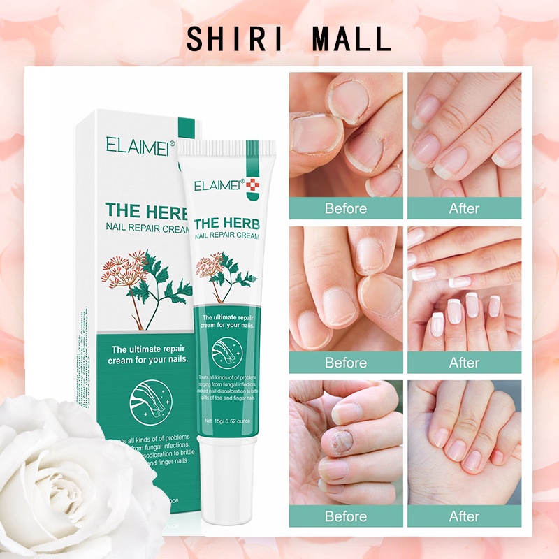SHIRI Serum Perawatan Kuku Jamur Kuku Gel Penghilang Jamur Kuku Kaki Anti Infeksi Onikomikosis Perba