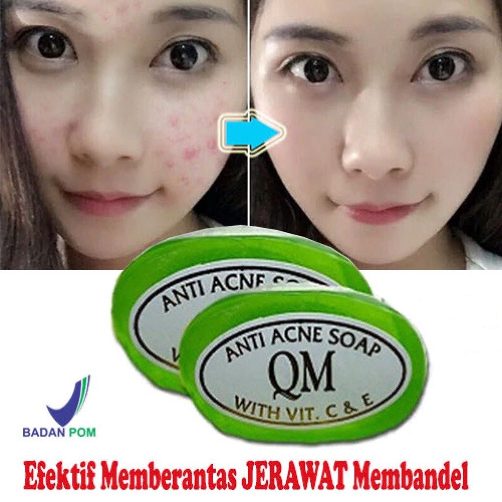 QM FACIAL SOAP FOR ACNE SKIN ORIGINAL BPOM - SABUN QM ANTI ACNE