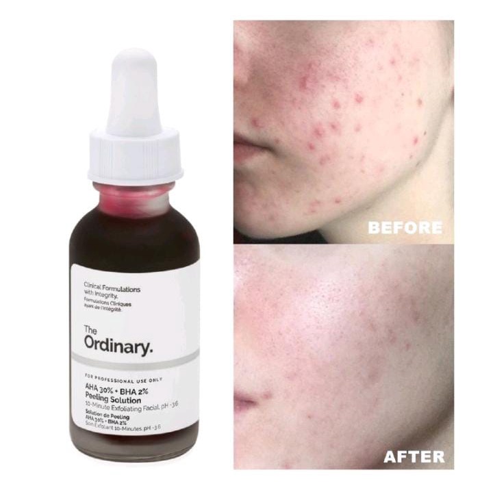 The Ordinary AHA 30%+BHA 2% Peeling Solution / Exfoliating faical pH-36 / Masker Wajah