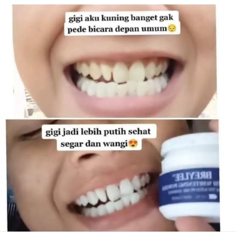 Breylee Teeth Whitening Powder