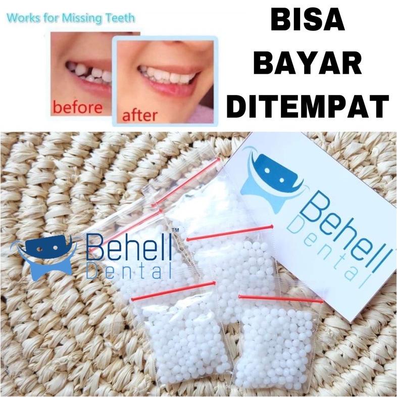 GIGI PALSU SEMENTARA 200 BUTIR / PENAMBAL GIGI PATAH RENGGANG TEMPORARY TOOTH TEMPTOOTH GINGSUL