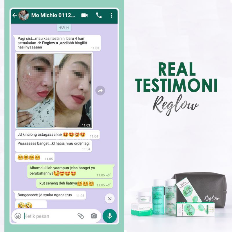 Reglow Perawatan Pencerah Wajah Original Glowing Skin Treatment Skincare BPOM-5