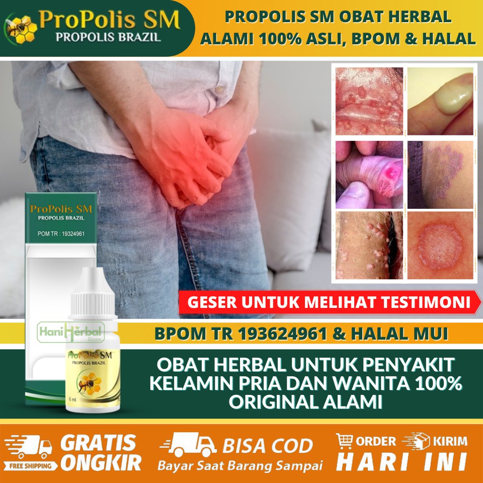 Jual Obat Herpes Genital Alami 100 ASLI Obat Herpes Genital Pada Pria Obat Herpes Genital