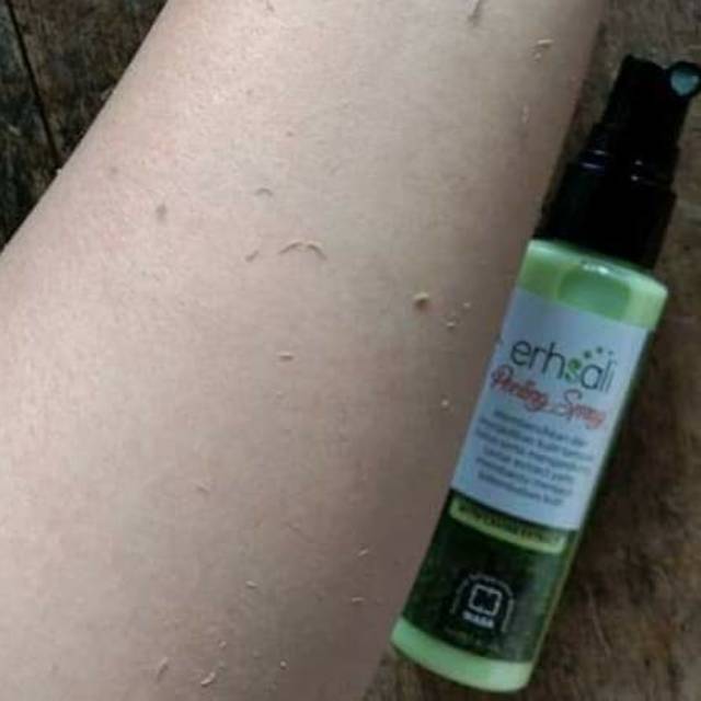 Ershali Peeling Spray Produk nasa penghilang daki kotoran komedo dan membersihkan kulit