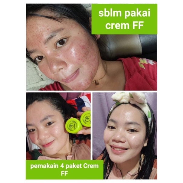 Paket glowing FF cream + serum whitening