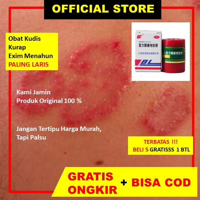 Salep Kulit Jerawat Salep Gatal Kemaluan Pria Produk ASLI Salep BL