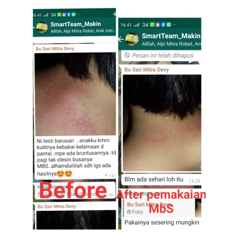 

multybeauty MBS