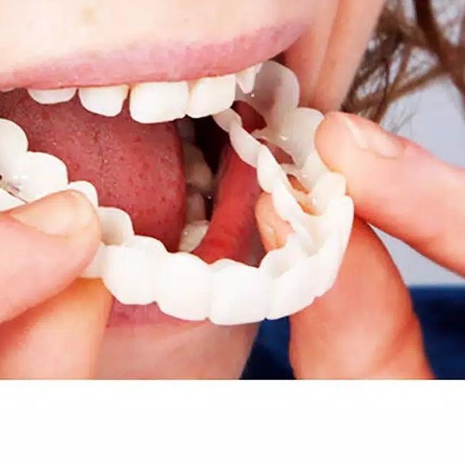 ✯ SNAP ON SMILE SEPASANG (GIGI ATAS dan GIGI BAWAH) ✿
