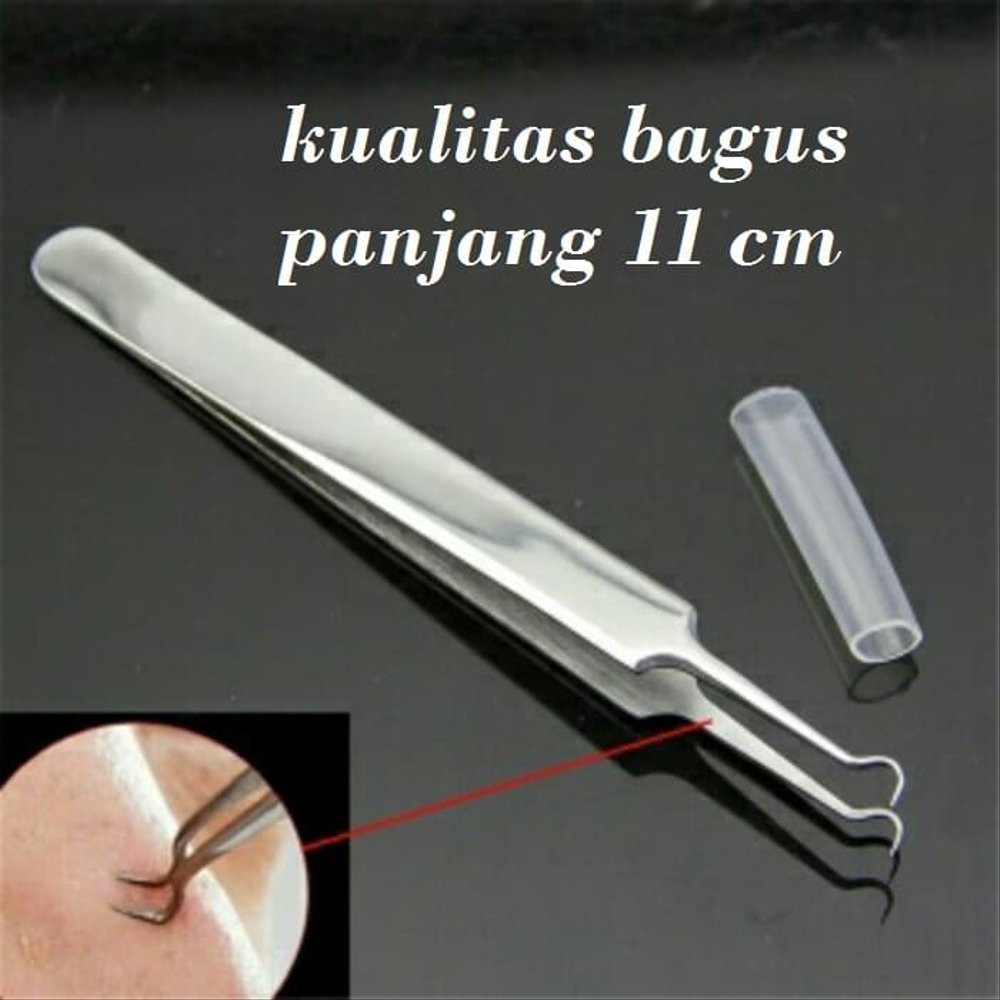 [Ready Stok] Penjepit Komedo Pinset Tweezer Pinset Komedo Japit Komedo Jerawat Hidung Pori - Pori Stainless