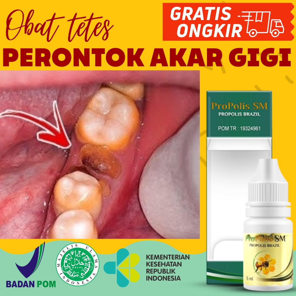 Obat Perontok Akar Gigi, Obat Penghancur Gigi Berlubang, Obat Tetes Perontok Gigi Berlubang, Obat Pe