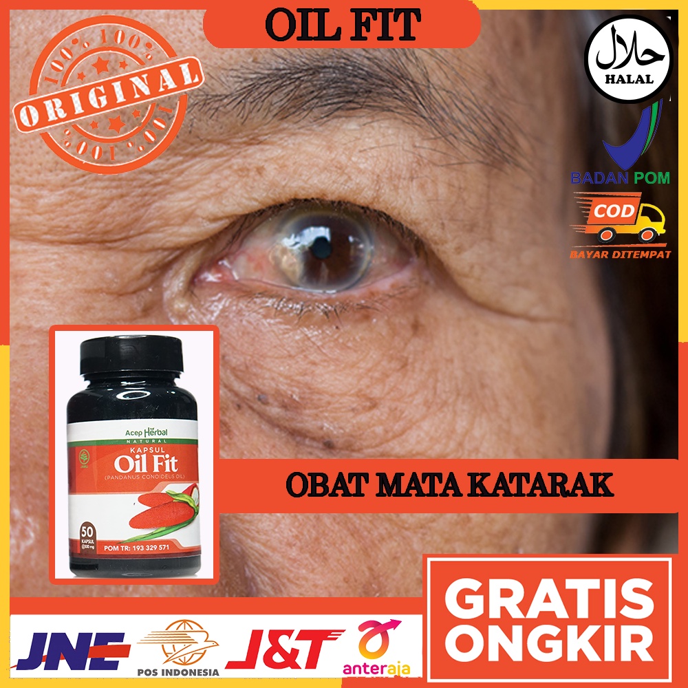 Obat Mata Katarak Mata Berlemak Mata Buram Mata Minus Rabun Jauh Dekat Bercak Mata Merah Iritasi Mat