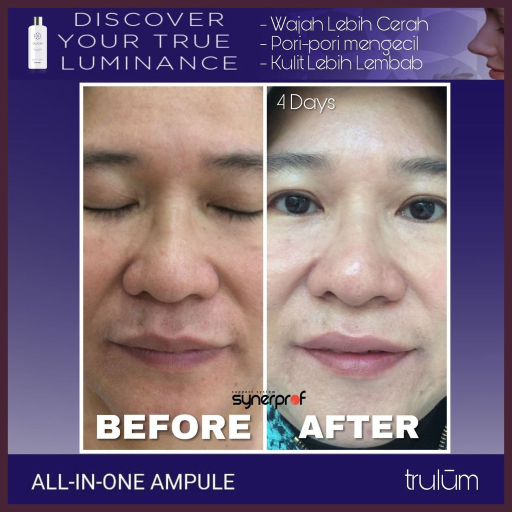 Krim Wajah Pria Wanita Obat Penghilang Flek Hitam Keriput Wajah Cepat