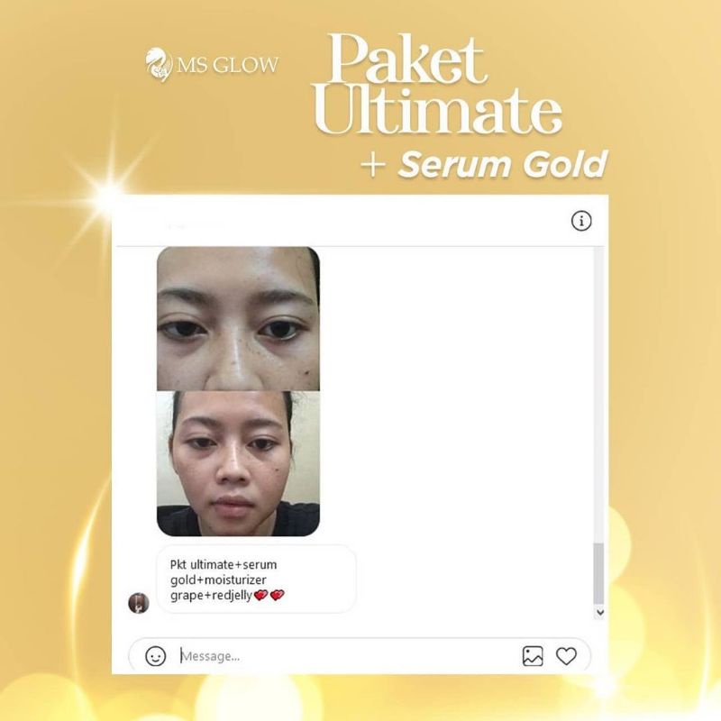 WHITENING GOLD SERUM MSGLOW, SERUM FLEK NODA HITAM SERUM SULTAN ANTI AGING