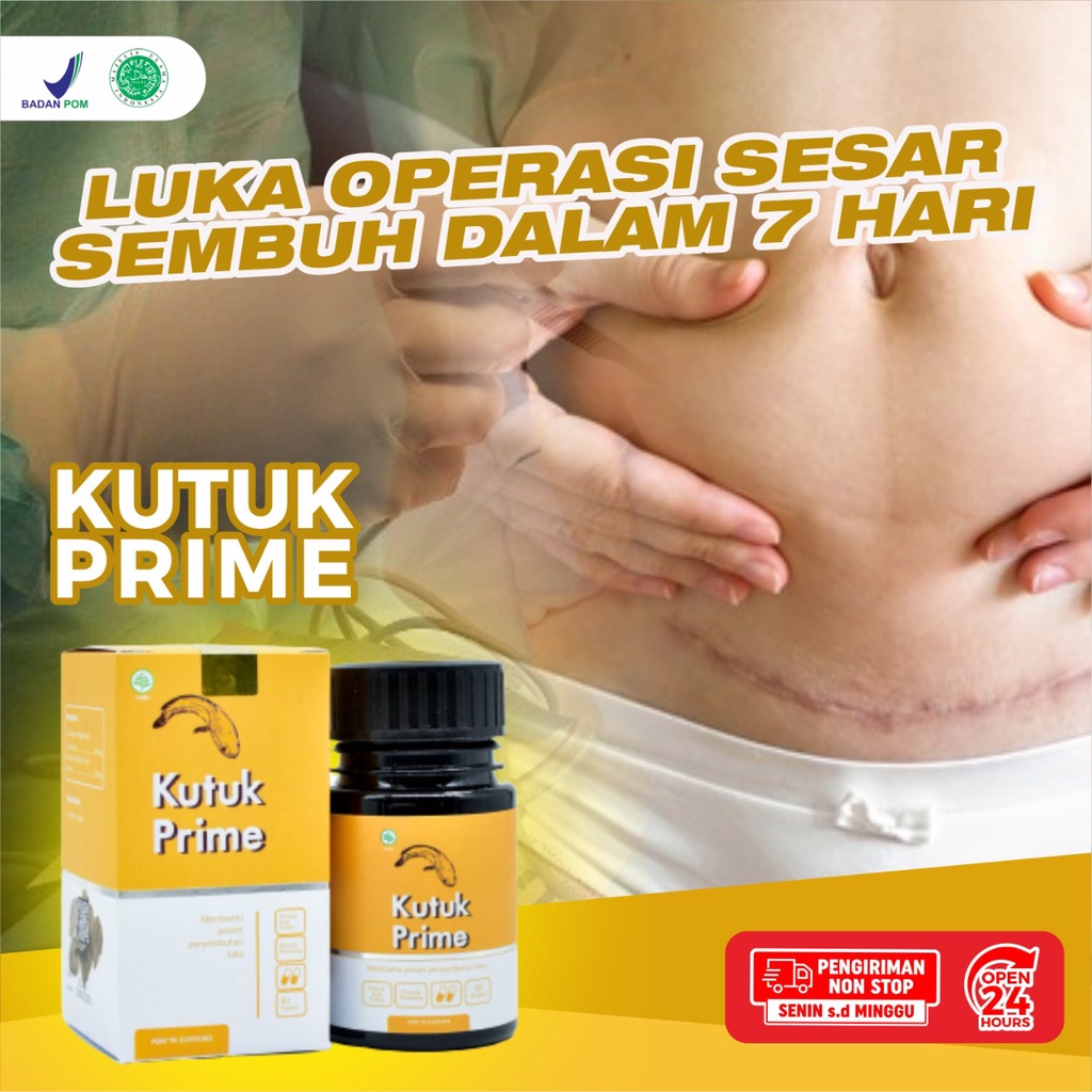 Paket 3 Botol Kapsul Kutuk Prime – Ekstrak Ikan Gabus Atasi Luka Operasi Sembuhkan Diabetes Cepat Keringkan Luka Operasi Cegah Infeksi Pada Luka Cegah Keloid Atasi Luka Bakar Kecelakaan Turunkan Kadar Gula Darah