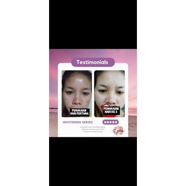 eglow/eglow 1 paket/eglow skincare