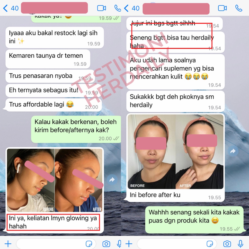 HER DAILY - PERBAIKI TEKSTUR KULIT DAN MEMUTIHKAN WAJAH DALAM 7 HARI - VIT D3 GLUTATHIONE