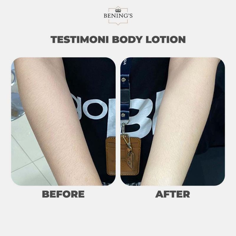 Body Lotion Bening's Skincare By Dr.Oky Pratama Benings Chroma Body Lotion Serum UV Protection Kromosom Glowing Bening Infus Whitening