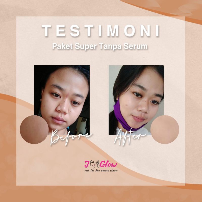 Jglow Skincare Paket Super no serum Whitening Skin Cream glowing(KEMASAN BARU RADIANCE NON SERUM)
