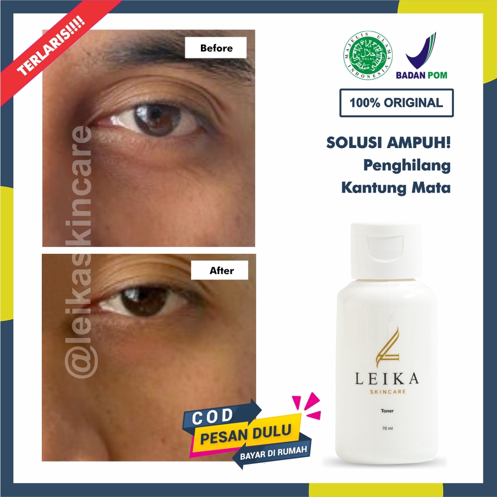 Penghilang Kantung Mata Terlaris Ampuh Permanen Halal Toner Kantung Mata Pria Aman BPOM Toner Menghi
