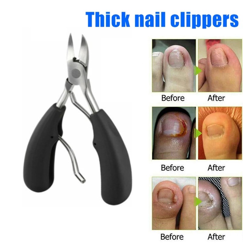 1pc Professional Stainless Steel Finger Toe Nail Clippers /Heavy Duty Toenail Safty For Thick Nails Or Ingrown Toenails Large