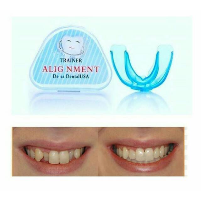 Teeth trainer (alat perapi gigi tonggos)