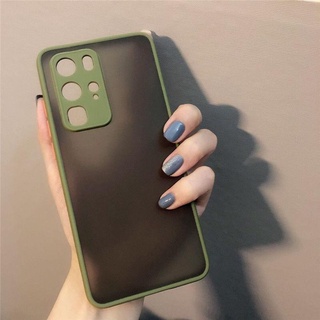 CASE MYCHOICE DOVE OPPO REALME GT MASTER PELINDUNG CAMERA