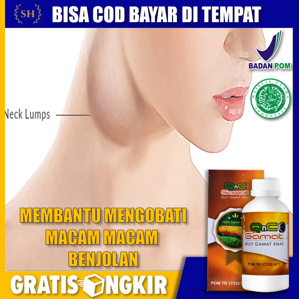 Obat Benjolan Herbal, Obat Benjolan Alami, Benjolan dileher, Benjolan di Kepala, - QnC Jelly Gamat