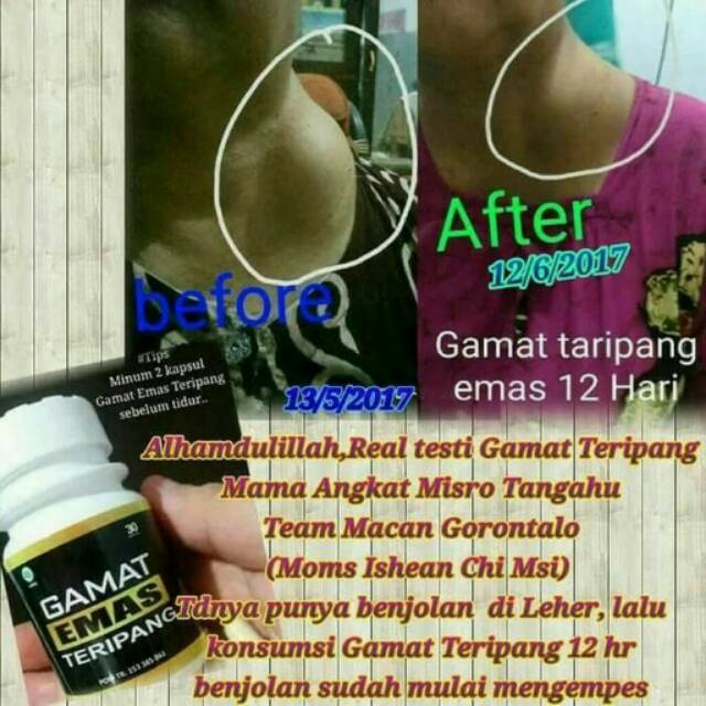 Gamat Teripang Emas MSI, original, asam urat, arthritis, benjolan, kapsul