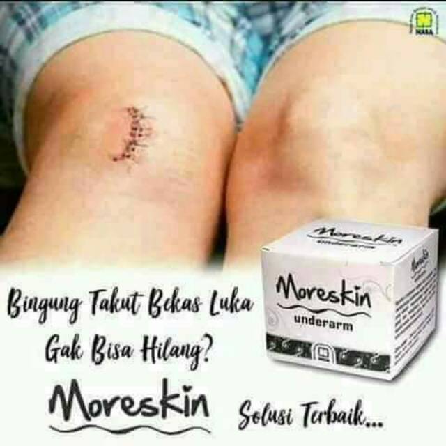 Moreskin underarm