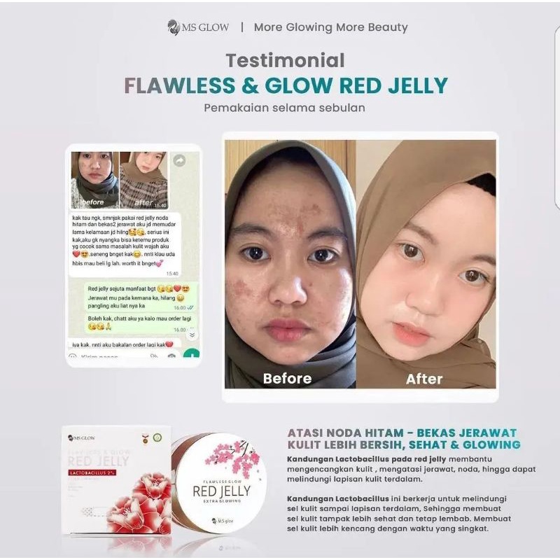 Paket Whitening + Red Jelly Lactobacillus || MS GLOW FREE POUCH