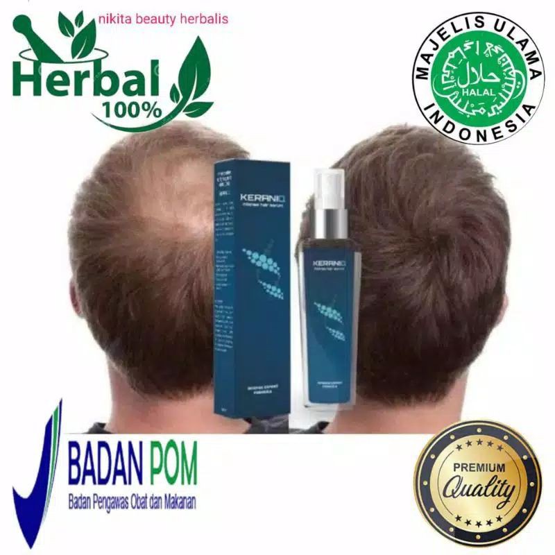 obat penumbuh rambut botak rontok asli original