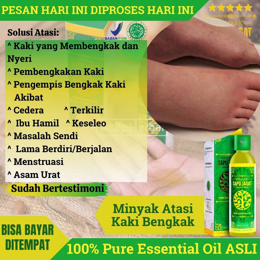 Jual Minyak Sapu Jagat Atasi Kaki Bengkak Alami Minyak Oles Gosok Pijak Kaki Yang Membengkak Dan Nyeri Pembengkakan Kaki Obat Pengempis Bengkak Kaki Akibat Cedera Terkilir Ibu Hamil Masalah Sendi