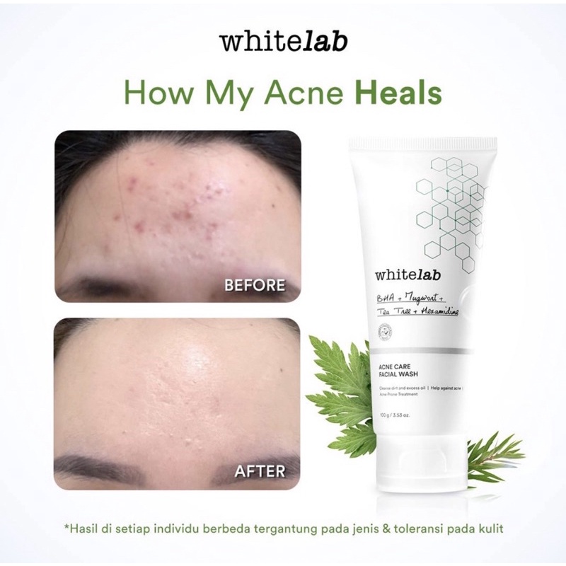 WHITELAB ACNE CARE FACIAL WASH -GC